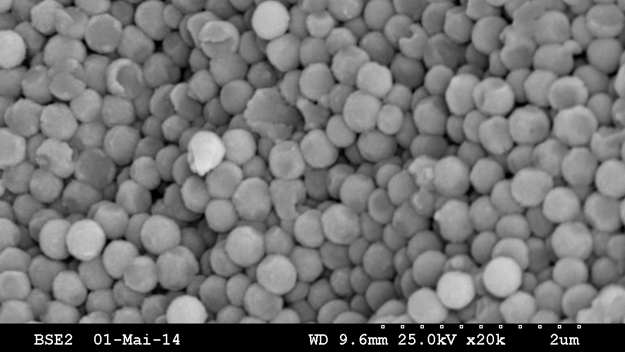 Synthetic dust particles under the microscope. ( Image: DCBP Univ. Bern/Beatrice Frey)